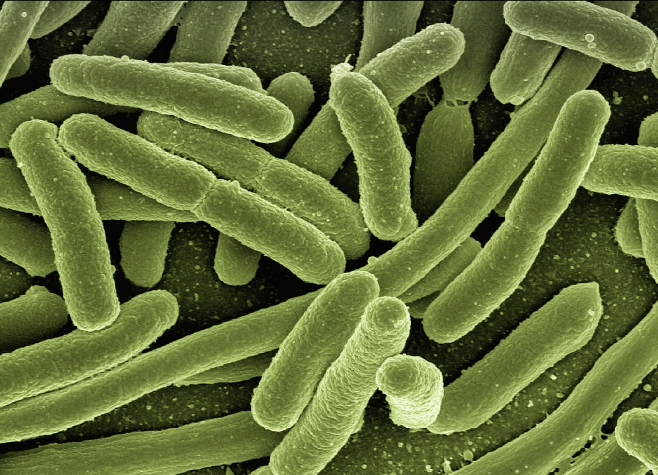 Characteristics of Escherichia coli